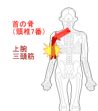 頸椎7番から上腕三頭筋