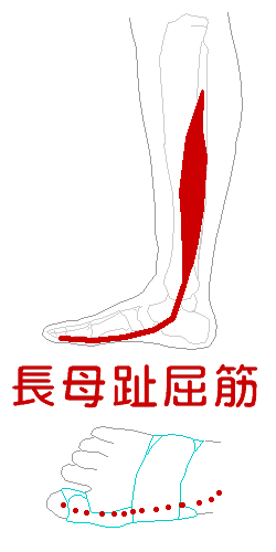 長母指屈筋は、外反母趾を防ぐ