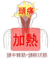 背部の加熱から頭痛