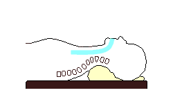 いびきまくら（気道確保）