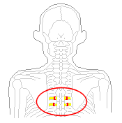 背中のツボ押しで痛めた部位