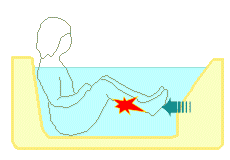 ジェットバスを足の裏へ当てすぎ