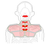 温パックと首の骨のズレ