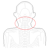 ムチ打ちで頚部の腫れ