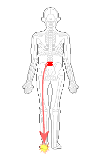 腰の骨から足への影響