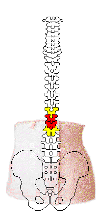 ウエストニッパ（コルセット）