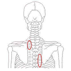 脇枕で肋椎関節と周辺の腫れ
