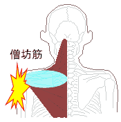 僧帽筋の冷え