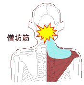 僧帽筋の冷え