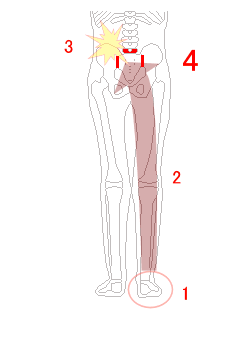右足首から左腰痛