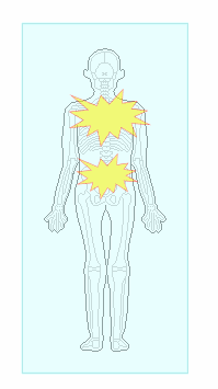 マットレスのへたりと体の痛む場所