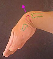 手を曲げた状態