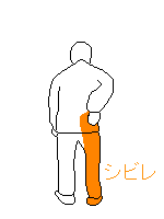 シビレまで悪化