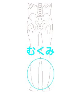 下肢のむくみ、足首痛