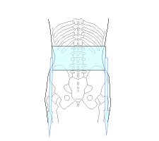 牽引で仙腸関節が炎症