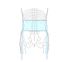 牽引で腰の骨1番が炎症