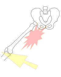 足が開きにくい