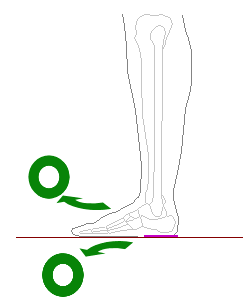 足の骨折で可動域低下