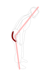 腰が伸びないのは、股関節の動きが悪い