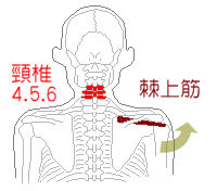 首の骨5番と棘上筋
