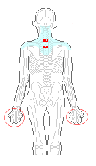 両肩こり　手のゴワゴワ感