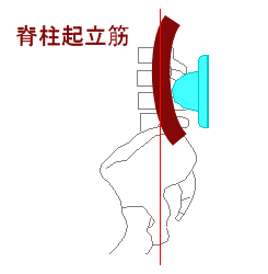 四つ玉で脊柱起立筋が変形