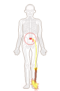腰の骨のズレが、足首に影響