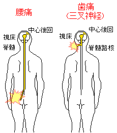 歯と腰痛