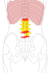 横隔膜から腰の骨のズレ