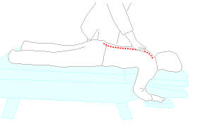 症状があるのに背骨が真っ直ぐ