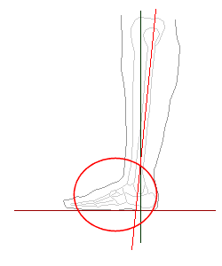 立位で、足が後方
