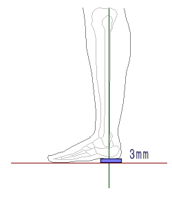 足底板　３mmがベスト