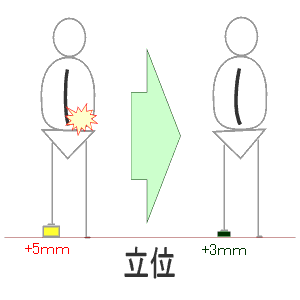 足底板5mmと3mm（立位）