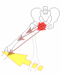 外転による障害