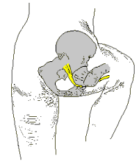 座骨神経と股関節