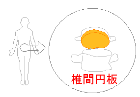 椎間円板